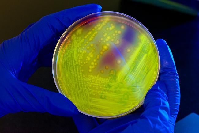 Kultur Clostridium difficile. Sumber: J Gathany, M Dankel, PHIL CDC, 2014.