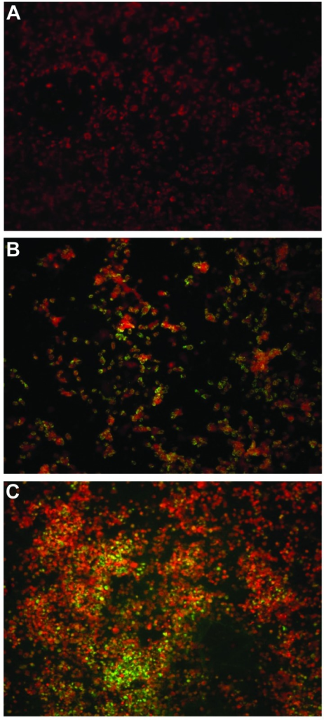 Kultur virus Coxsackie B. Sumber: anonim, Openi, 2014.