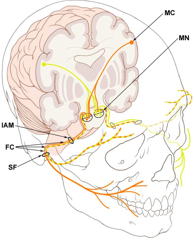 Jaras Nervus Fasialis. Sumber : Lynch PJ, Wikimedia Commons, 2006.