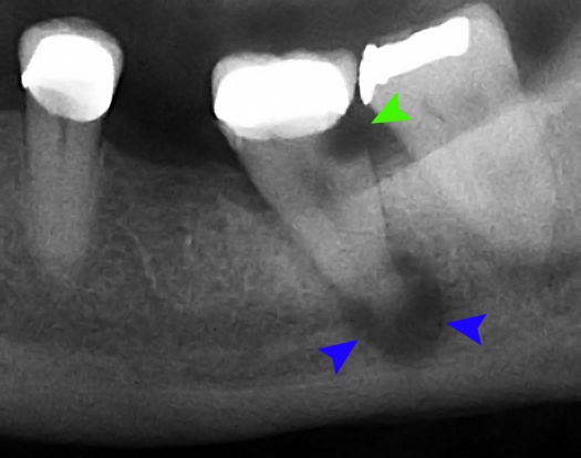 Sumber: Coronation Dental Specialty Group, Wikimedia commons, 2014.