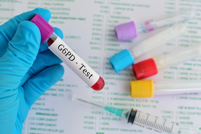 Defisiensi Glukosa 6 Fosfat Dehidrogenase G6pd Patofisiologi Diagnosis Penatalaksanaan Alomedika