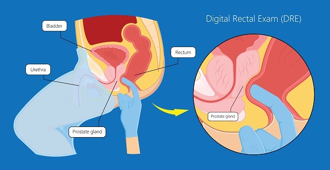 boggy prostate on dre)