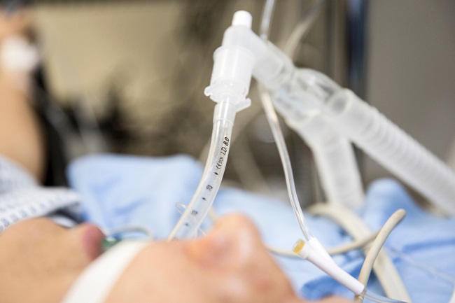  Intubasi  dan Ventilasi pada Pasien ARDS dengan COVID 19 