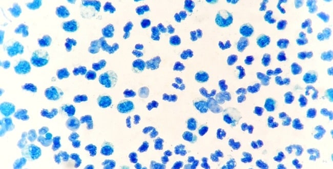 Pemeriksaan Bakteri Tahan Asam Bta Patofisiologi Diagnosis Penatalaksanaan Alomedika