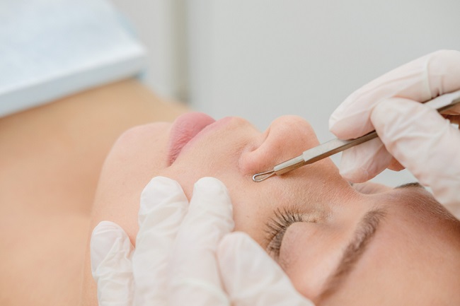 Treatment menghilangkan komedo