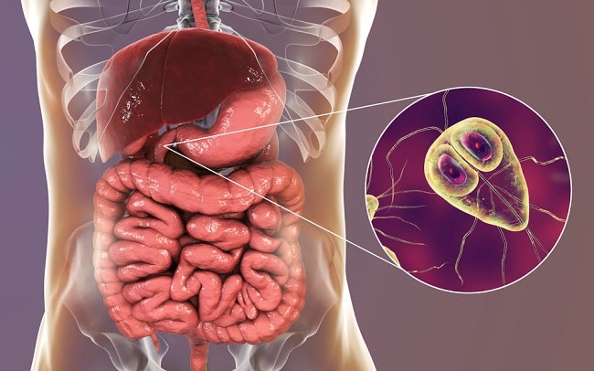 Infecția cu Giardia poate afecta pe oricine - Smart Medical